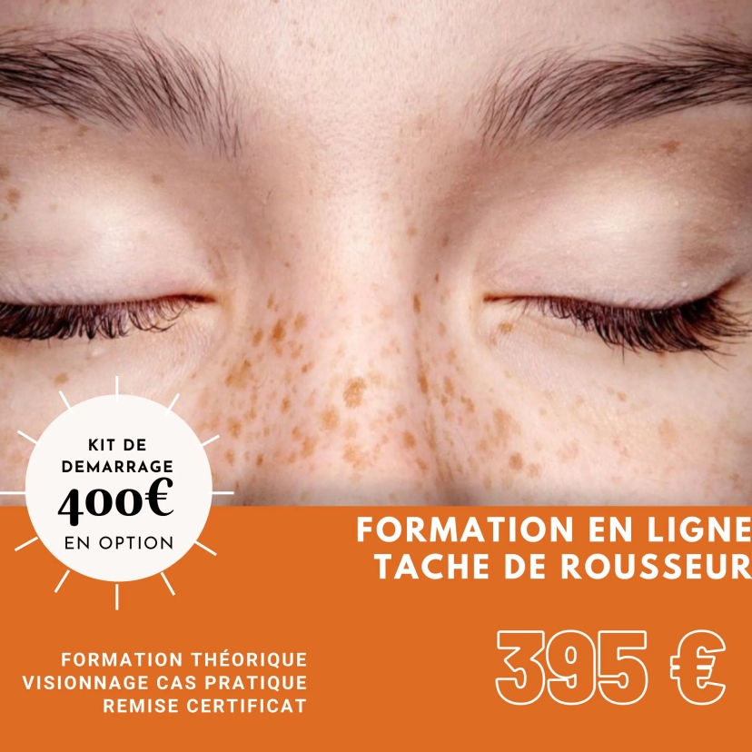 Informations de Formation Tâche de rousseur en ligne