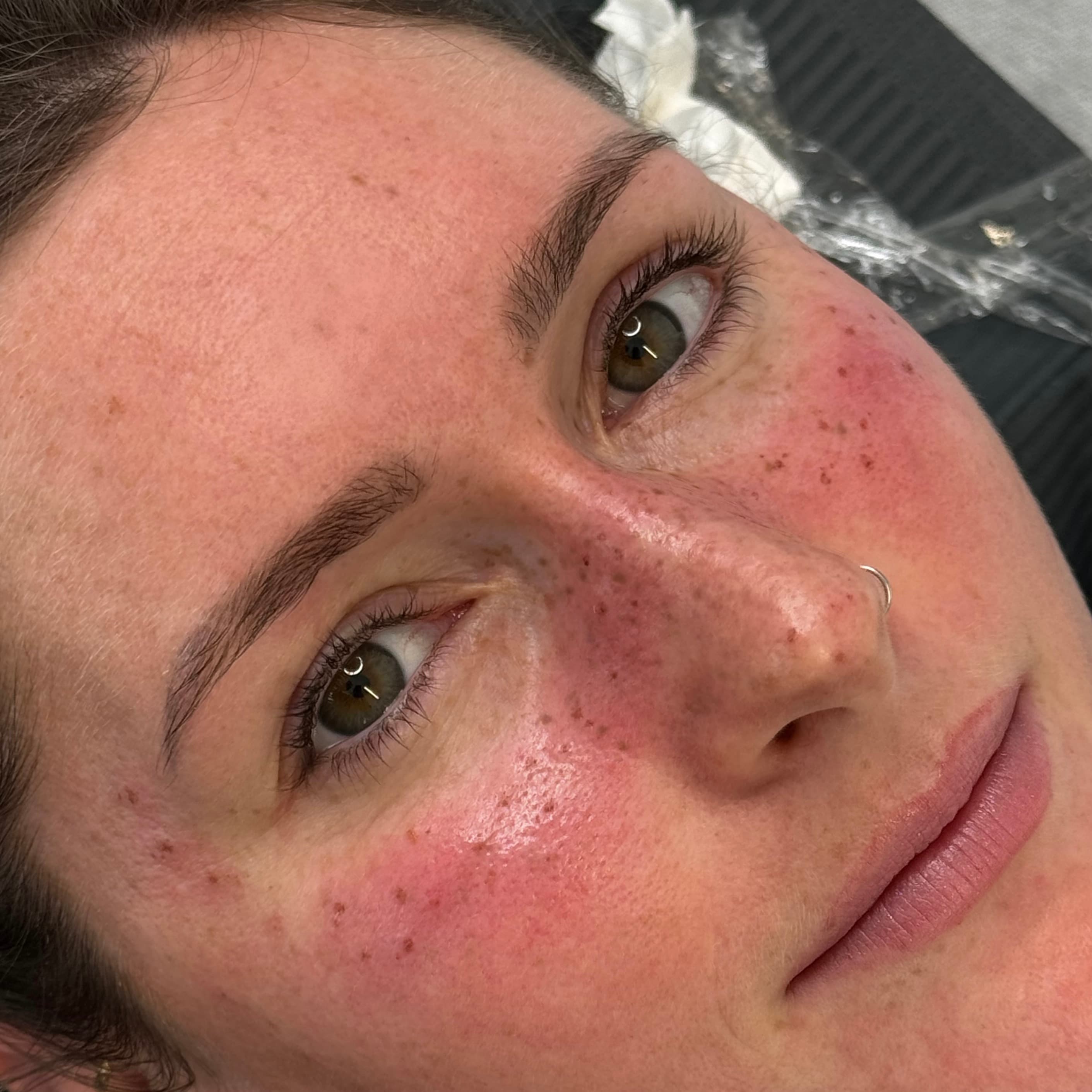 Taches de rousseur créées par dermopigmentation sur le visage, prestation réalisée à Dijon chez Habiba Med.