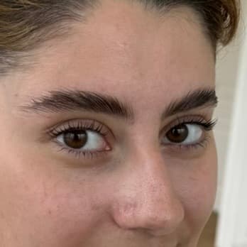 Rehaussement naturel des sourcils bruns par browlift à Dijon chez Habiba Med, rendu soigné