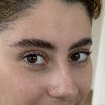 Rehaussement naturel des sourcils bruns par browlift à Dijon chez Habiba Med, rendu soigné